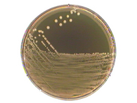 M 17 AGAR ACC. TO TERZAGHI FOR MICROBIOL